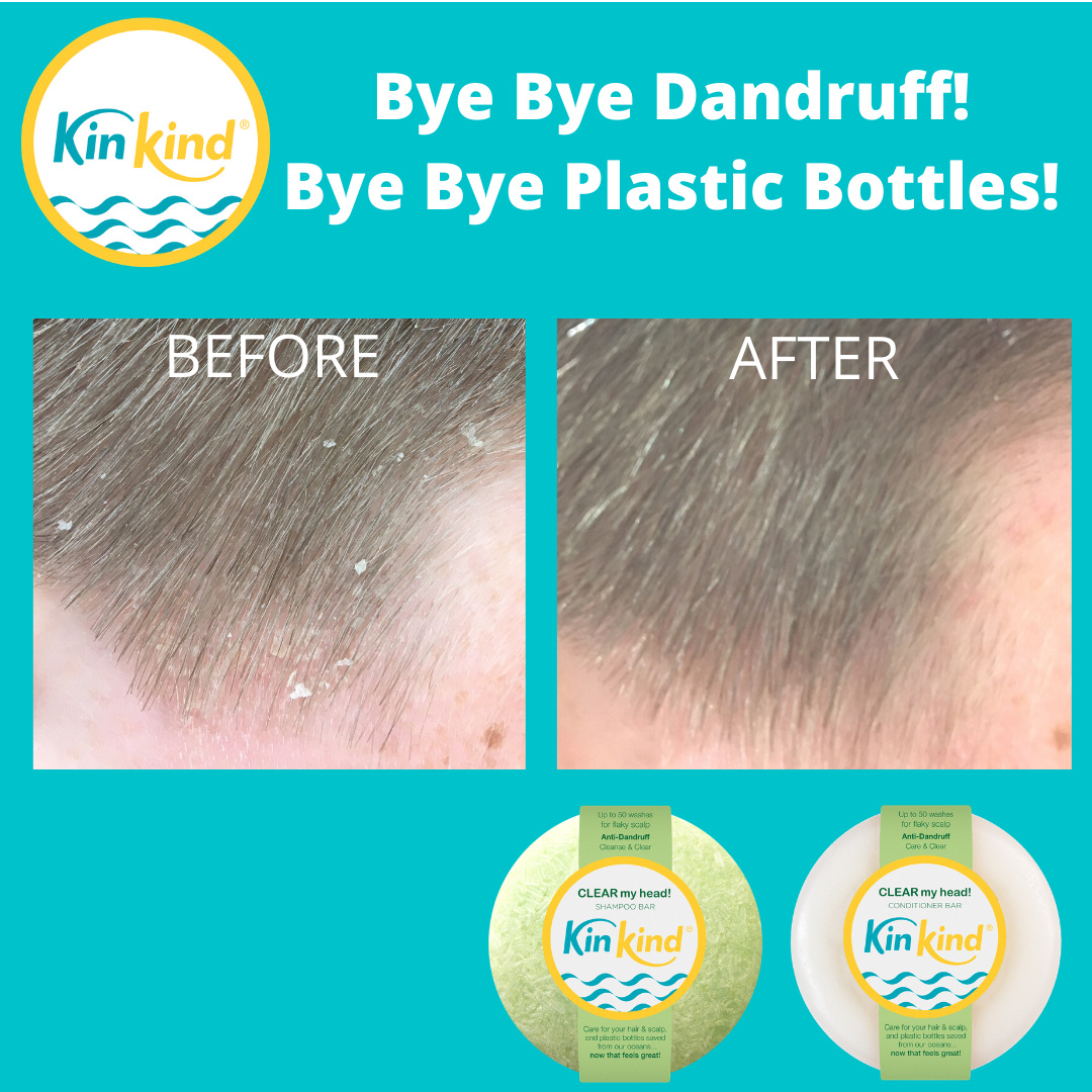 Bye bye DANDRUFF and PLASTIC BOTTLES! New KinKind CLEAR my head! bars